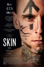 Watch Skin M4ufreemovies