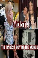 Watch Aidan The Rarest Boy In The World M4ufreemovies