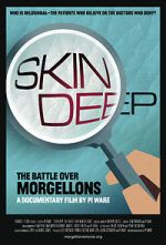 Watch Skin Deep: The Battle Over Morgellons M4ufreemovies
