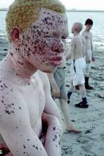 Watch Albino United M4ufreemovies