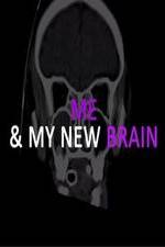 Watch Me & My New Brain M4ufreemovies