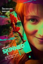 Watch Skinned M4ufreemovies