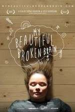 Watch My Beautiful Broken Brain M4ufreemovies