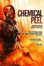 Watch Chemical Peel M4ufreemovies