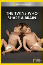 Watch National Geographic The Twins Who Share A Brain M4ufreemovies