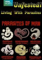 Watch Infested! Living with Parasites M4ufreemovies