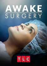 Watch Awake Surgery M4ufreemovies